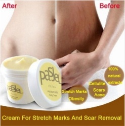 Pasjel Cream Stretch Marks And Scar Removal