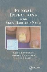 Fungal Infections Of The Skin And Nails Paperback