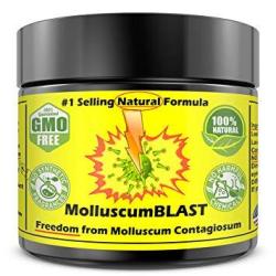 Molluscum Contagiosum Treatment Cream Kids Adults 15 Essential Oils & Fda Approved Bht Vanishing Stick Natural Contagium Quickly Control Stop 1SELL
