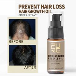 Lucoss Hair Loss Products Powerful Hair Growth Essence Fluid Treatment With Essential Oils Prevents Hair Loss