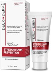 Deux Derme - Stretch Mark Prevention Cream With Vitamin E Cocoa Butter For Pregnancy Weight Gain 3.4 Oz.